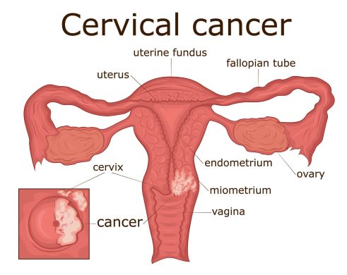 cervical