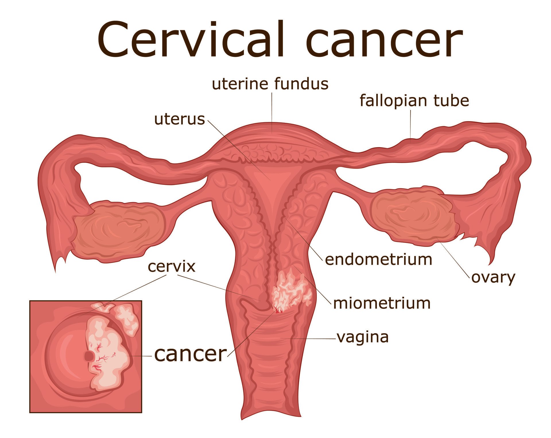 Cervical